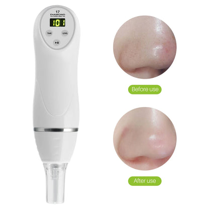 6 Tip Facial Skin Care Beauty Device Skin Diamond Dermabrasion Removal Scar Acne Pore Peeling Machine Massager Microdermabrasion