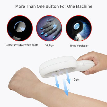 NEW Woods Lamp Woods Light Skin Examination Skin Fungus Detector Vitiligo Pityriasis Versicolor Melasma Detector