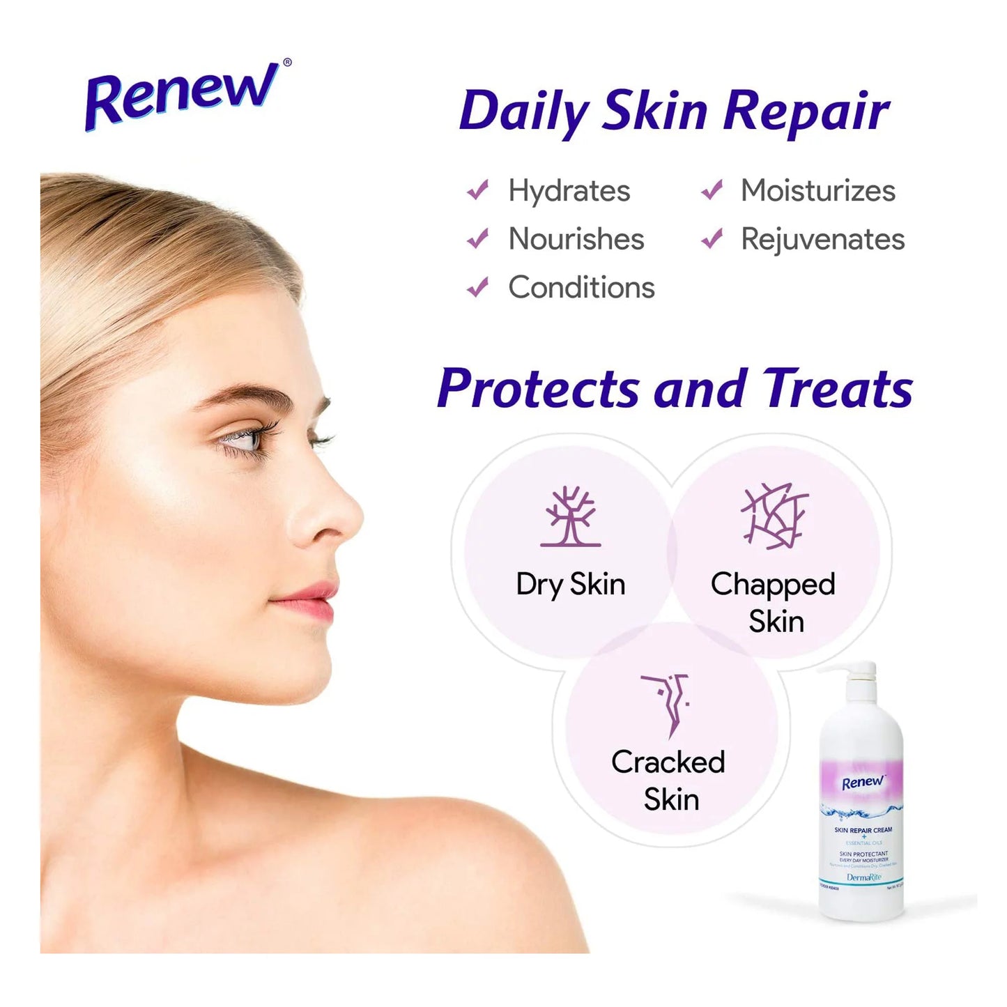 Renew Skin Repair Scented Hand and Body Moisturizer Cream 400